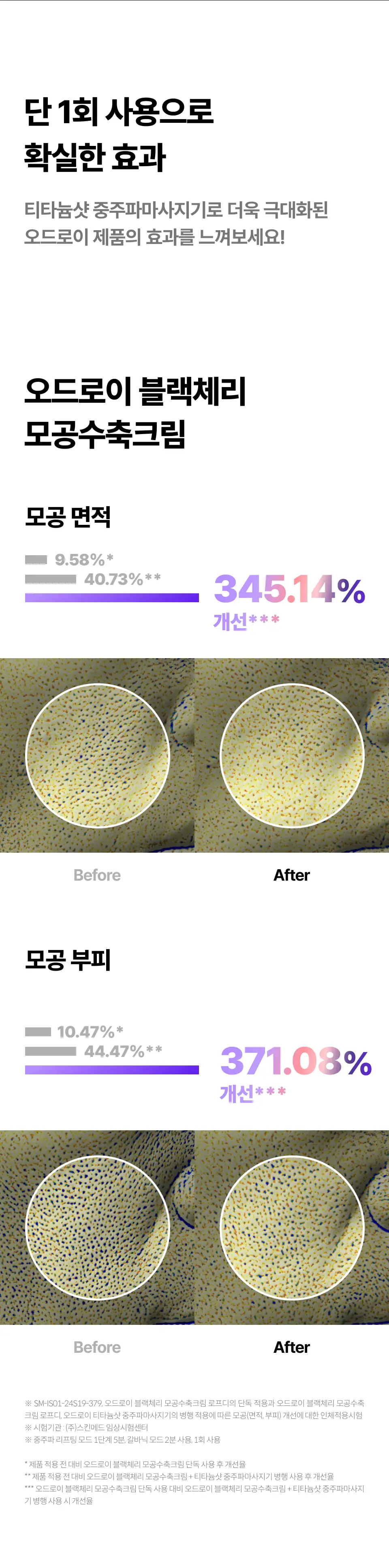 [이중턱/윤곽] 오드로이 모공수축 중주파마사지기 티타늄샷 기획(+모공수축크림 100ml 본품 증정) 상세페이지 3